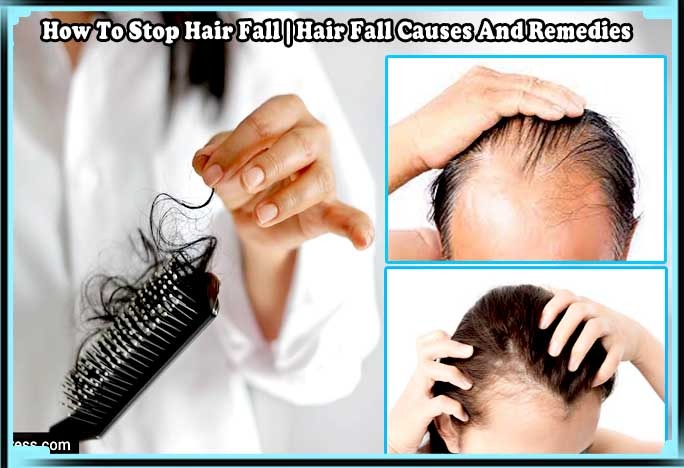 How To Stop Hair Fall, Hair Fall Causes And Remedies